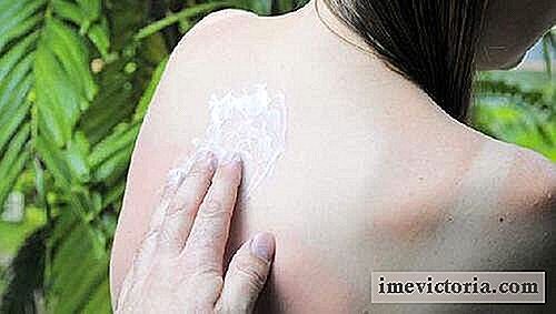 5 Tipů, aby se zabránilo spálení pokožky a kůže na úkoly
