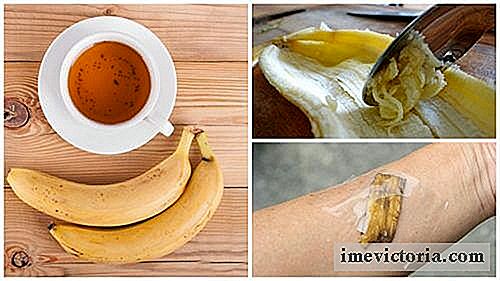 5 Måter å bruke bananskall som et naturlig middel