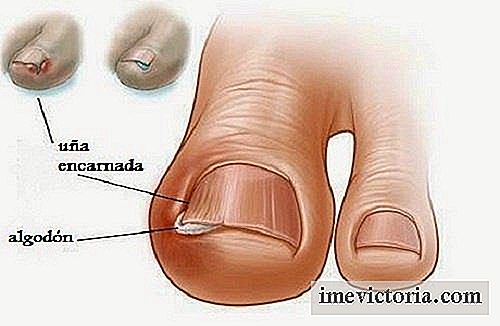 6 Forfædres retsmidler til at lindre nedgroede tånegle