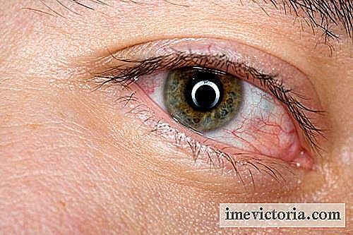 6 Domácí opravné prostředky na zmírnění unavené oči