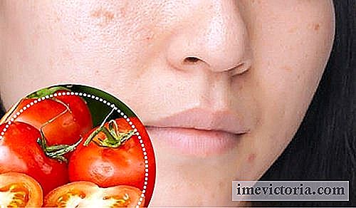 6 Naturlige ingredienser til at blødgøre ansigts pletter