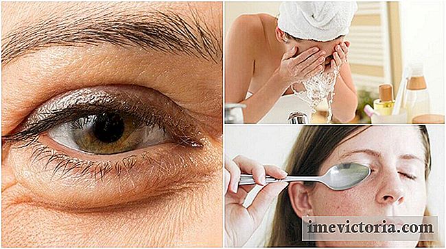 6 Métodos naturales para reducir bolsas debajo de los ojos