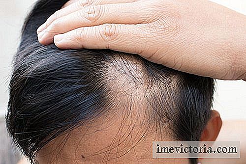 6 Přírodní prostředky pro léčbu plešatosti
