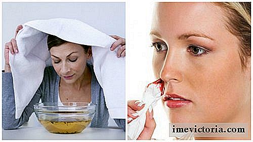 7 Soluciones caseros eficaces contra hemorragias nasales