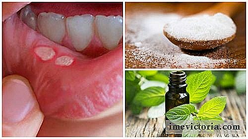7 Hjem behandlinger for å kurere munnsår