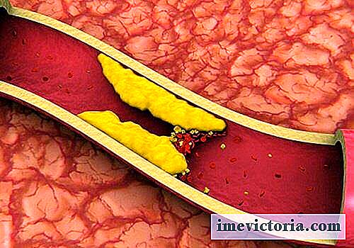 8 Infúze ke snížení hladiny cholesterolu