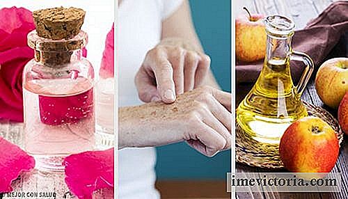 8 Remedios naturales para eliminar manchas en las manos