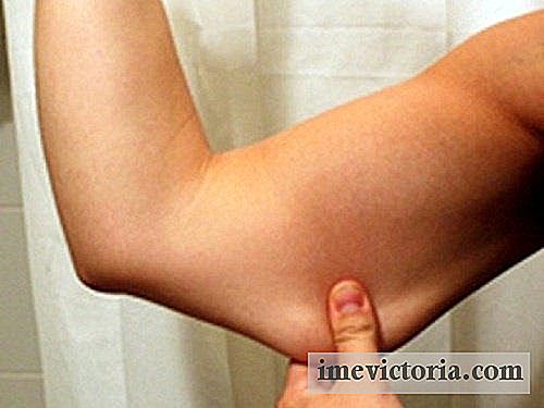 Un método casero para tratar la flacidez de los brazos