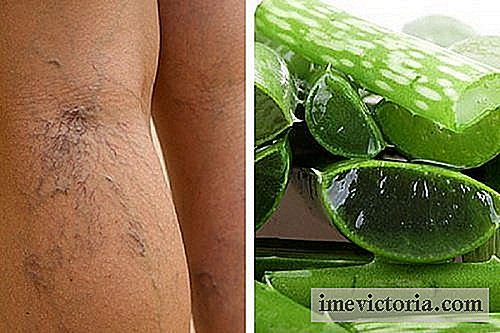 Aloe vera å behandle åreknuter magesår