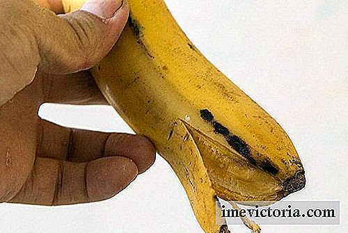Si blanquear los dientes con cáscara de plátano