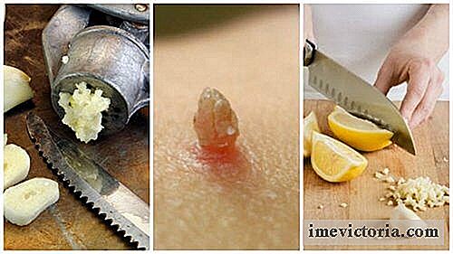 Odstranění bradavice zacházení s česnekem a citronem