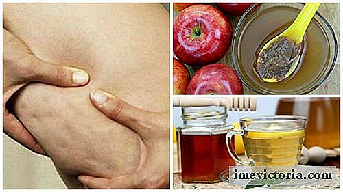 Kæmp cellulite med dette naturlige præparat af æbleeddike og honning