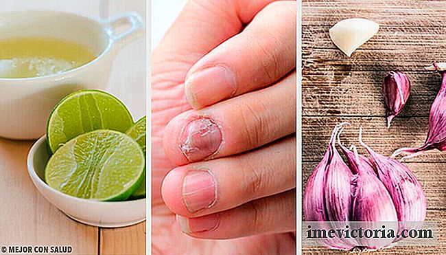 Home Remedies for Nail Svampe