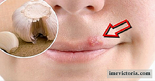 Remedios caseros para el alivio rápido del herpes labial