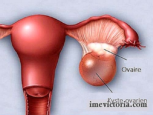 Jak předcházet a včas odhalovat ovariální cysty