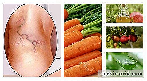 Tratamiento natural contra las venas varicosas con aloe vera, zanahoria y vinagre de manzana