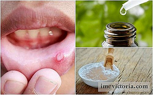 Lindre sår i munden med disse 6 naturmedicin