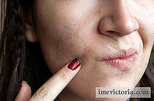 Los 7 errores cometidos en el cuidado de la piel