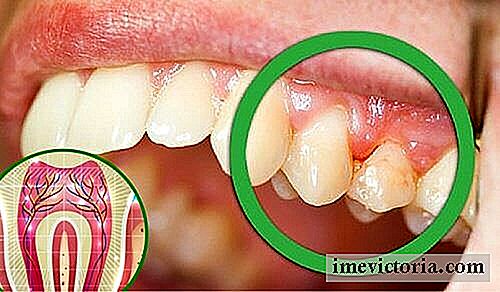 6 åRsager til, at dine tænder gør ondt