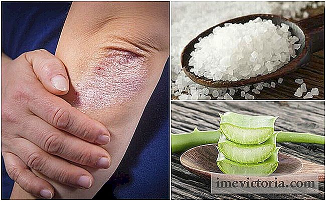 Hvordan å bekjempe sopp på huden med 5 naturlige løsninger